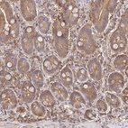 Immunohistochemical staining of human duodenum shows high expression.