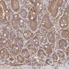 Immunohistochemical staining of human duodenum shows high expression.