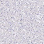 Anti-S100G Antibody