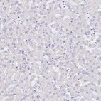 Immunohistochemical staining of human liver shows low expression as expected.