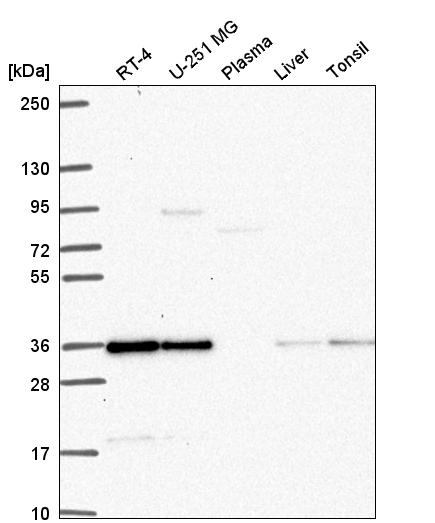 Anti-DERA Antibody
