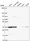 Anti-DERA Antibody