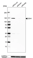 Western blot analysis in MCF-7 cells transfected with control siRNA, target specific siRNA probe #1 and #2, using Anti-CDH1 antibody. Remaining relative intensity is presented. Loading control: Anti-GAPDH.