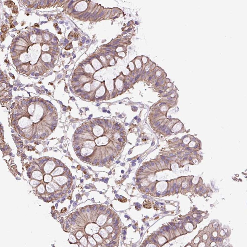 Anti-OR13D1 Antibody