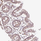 Anti-OR13D1 Antibody