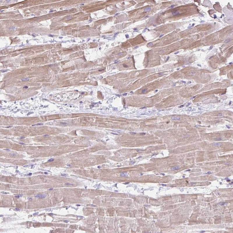 Anti-CDRT15 Antibody