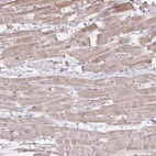 Anti-CDRT15 Antibody