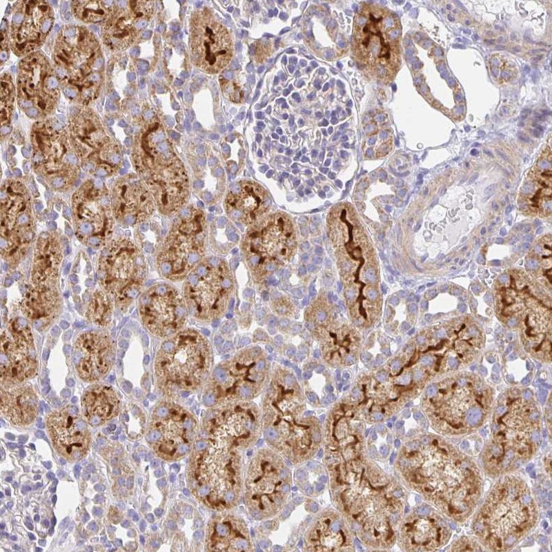 Anti-FLRT3 Antibody