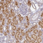 Anti-FLRT3 Antibody