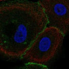 Immunofluorescent staining of human cell line hTCEpi shows localization to plasma membrane & cell junctions.