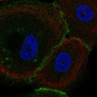 Immunofluorescent staining of human cell line hTCEpi shows localization to plasma membrane & cell junctions.