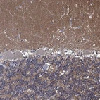 Anti-ZNF671 Antibody