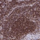 Anti-ERI1 Antibody