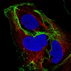 Immunofluorescence staining of BEWO cells using the Anti-CDH1 monoclonal antibody, showing specific staining in the plasma membrane and cell junctions in green. Microtubule- and nuclear probes are visualized in red and blue, respectively (where available).