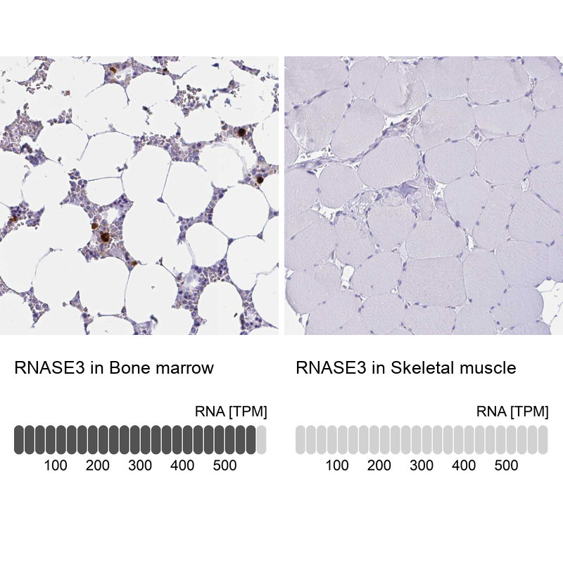 Anti-RNASE3 Antibody