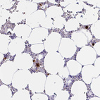 Immunohistochemical staining of human bone marrow shows strong cytoplasmic positivity in hematopoietic cells.