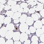 Immunohistochemical staining of human bone marrow shows strong cytoplasmic positivity in hematopoietic cells.