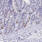 Immunohistochemical staining of human duodenum shows strong cytoplasmic positivity in a subset of lymphoid cells.