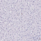 Immunohistochemical staining of human liver shows no positivity in hepatocytes as expected.
