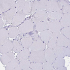 Immunohistochemical staining of human skeletal muscle shows no positivity in myocytes as expected.