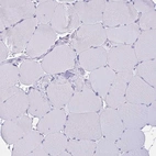 Immunohistochemical staining of human skeletal muscle shows no positivity in myocytes as expected.