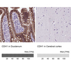 Anti-CDH1 Antibody