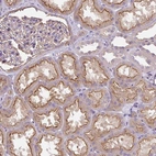 Anti-PIP5KL1 Antibody