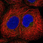 Immunofluorescent staining of human cell line HEK 293 shows localization to cytosol.