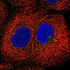 Immunofluorescent staining of human cell line HEK 293 shows localization to cytosol.