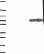 Anti-SLC28A1 Antibody