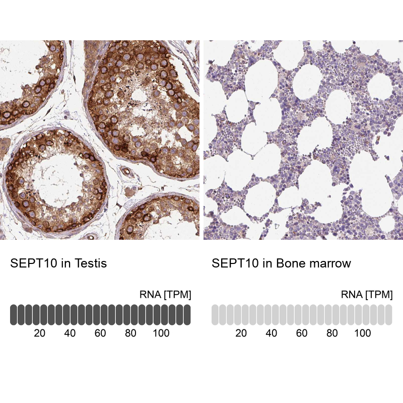 Anti-SEPT10 Antibody