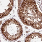 Immunohistochemical staining of human testis shows strong cytoplasmic positivity in cells in seminiferous ducts and moderate staining in Leydig cells.