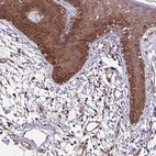Immunohistochemical staining of human skin shows strong cytoplasmic positivity in squamous epithelial cells.