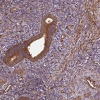 Immunohistochemical staining of human endometrium shows moderate cytoplasmic positivity in glandular cells and endometrial stromal cells.