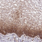 Immunohistochemical staining of human cervix, uterine shows moderate cytoplasmic positivity in squamous epithelial cells.