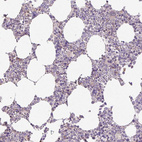 Immunohistochemical staining of human bone marrow shows negative cytoplasmic positivity in hematopoietic cells as expected.
