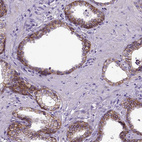 Anti-CDH1 Antibody