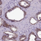 Immunohistochemical staining of human prostate shows strong membranous positivity in glandular cells.