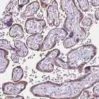 Immunohistochemical staining of human placenta shows moderate positivity in trophoblastic cells.