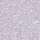 Immunohistochemical staining of human liver shows no positivity in hepatocytes as expected.