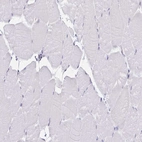 Immunohistochemical staining of human skeletal muscle shows no positivity in myocytes as expected.