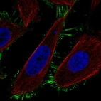 Immunofluorescent staining of human cell line PC-3 shows localization to plasma membrane.