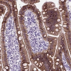 Immunohistochemical staining of human duodenum shows strong membranous positivity in glandular cells.