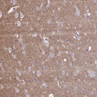 Anti-NTN1 Antibody