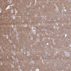 Anti-NTN1 Antibody