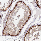 Anti-ARHGAP35 Antibody