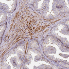 Anti-ARHGAP35 Antibody