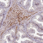Immunohistochemical staining of human prostate shows moderate cytoplasmic positivity in smooth muscle cells.