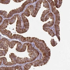 Immunohistochemical staining of human fallopian tube shows moderate to strong cytoplasmic positivity in glandular cells.