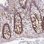 Immunohistochemical staining of human colon shows moderate cytoplasmic positivity in glandular cells.